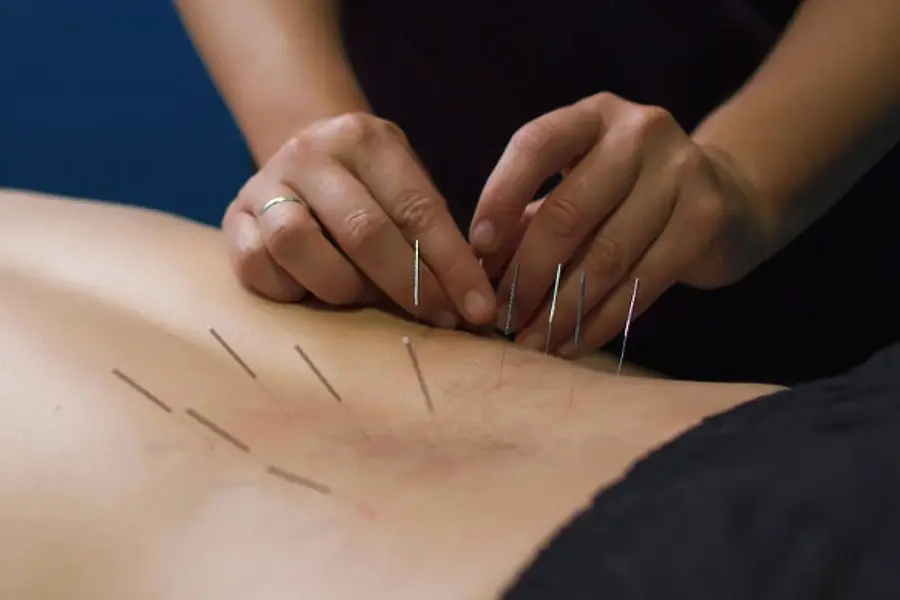 Dry Needling